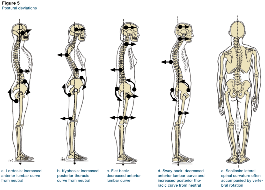 Postural deviations, nor Deviant Art